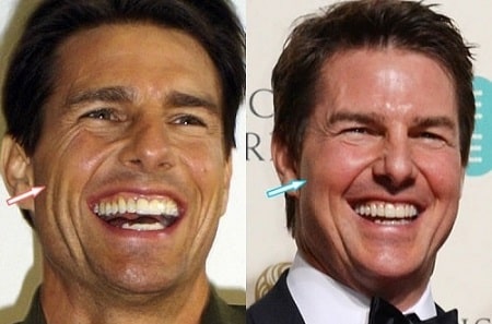 A before and after picture of Tom Cruise.